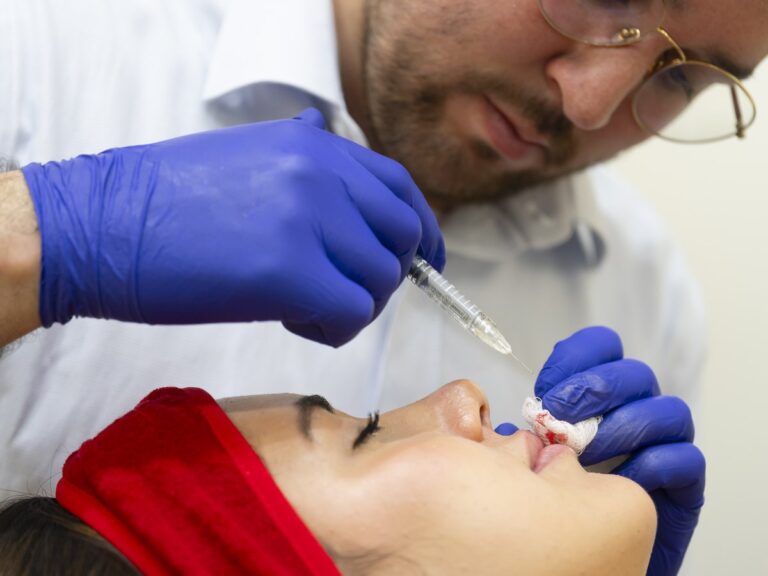 Medico aplicando relleno de acido hialuronico en labios